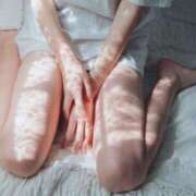 ヒメ日記 2025/07/16 11:29 投稿 ゆずりは SUZUME