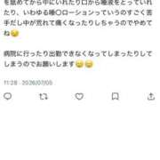 ヒメ日記 2026/07/05 11:36 投稿 らな 男爵