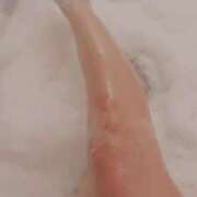 ヒメ日記 2025/07/21 10:09 投稿 まりか 完熟ばなな札幌・すすきの