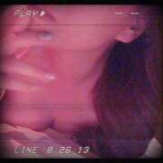 ヒメ日記 2025/08/08 11:38 投稿 服部　しゅり エテルナ彦根