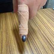 めい 仕事で負傷？？？？ 僕のぽっちゃり伝説