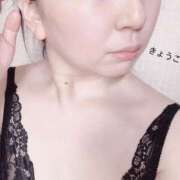 ヒメ日記 2025/08/17 15:50 投稿 きょうこ スイカ