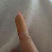 ヒメ日記 2025/08/08 12:50 投稿 ミサキ ナポレオン