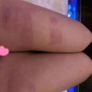 ヒメ日記 2026/02/22 10:12 投稿 かずの Seirenes (セイレネス)