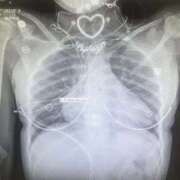 ヒメ日記 2025/09/09 22:39 投稿 あいり 横浜しこたまクリニック