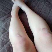 ヒメ日記 2025/08/08 08:41 投稿 みつき 宮城仙南ちゃんこ