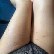 ヒメ日記 2025/07/01 18:51 投稿 あゆむ 即アポマダム～名古屋店～