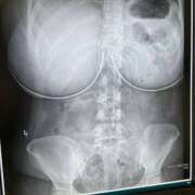 ヒメ日記 2026/03/13 14:11 投稿 とうふ【Kカップの絶対衝撃】 STELLA NEXT－ステラネクスト－