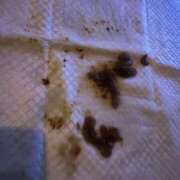 ヒメ日記 2025/11/18 14:00 投稿 きら 排泄マニア