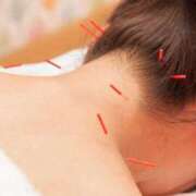 ヒメ日記 2026/03/18 20:51 投稿 『あんり』 ESSENCE