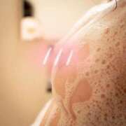 ヒメ日記 2026/01/11 18:35 投稿 愛蝶エレン ゴールドクイーン