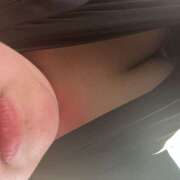 朝倉 あついです‥ 名古屋デッドボール