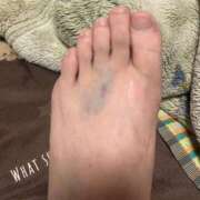 ヒメ日記 2025/11/23 07:10 投稿 大貫 鶯谷デッドボール