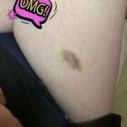 ヒメ日記 2025/08/28 16:48 投稿 ゆい 福岡大野城・板付インターちゃんこ