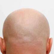 ヒメ日記 2026/01/22 21:45 投稿 みつ La Rouge(中津)