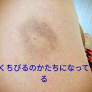 ののか あざが 人妻美人館