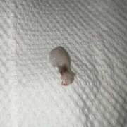 ヒメ日記 2026/01/10 22:41 投稿 ゆん Versailles