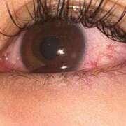 おいち♪ ごめんね😣 水色りぼん