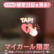 アリス 丸見えだよ ?? マテリアル