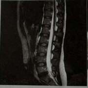 ヒメ日記 2025/01/18 12:49 投稿 望月れいか 宝石箱(すすきの)